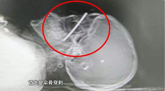 人生就是博：危险！自行车上不要加装这些物品！(图1)