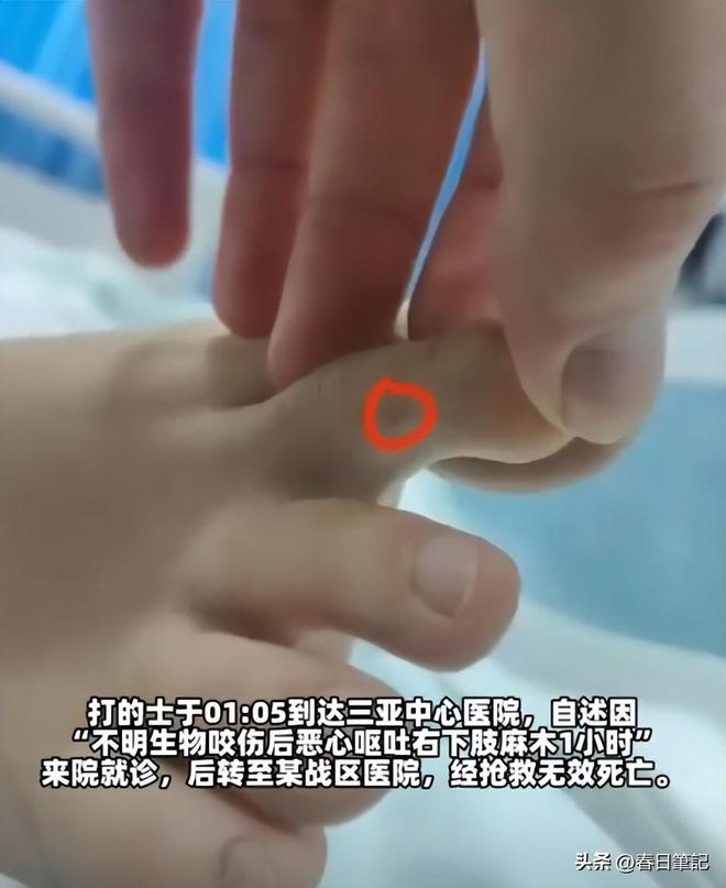 尊龙凯时网站：女游客被蛇咬身亡后续！身份信息曝光家属发声抢救后称没经验(图3)